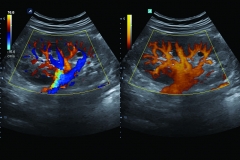 ecube15_platinum_gallery10_kidney_in_cf_and_pd_mode