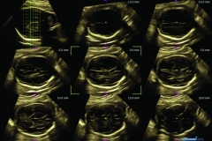 ecube15_platinum_gallery14_fetal_brain_with_free_angle_msv