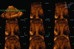 ecube15_platinum_gallery16_uterus_with_free_angle_msv