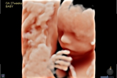 ecube15_platinum_gallery17_3d_fetus_with_live_hq