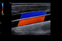 ecube15_platinum_gallery1_carotid_artery_and_jugular_vein_in_color