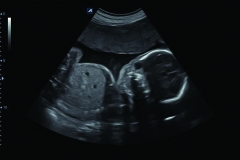 ecube15_platinum_gallery23_fetus_at_24_weeks_in_2d