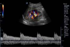 ecube9_diamond_gallery16_normal_spectral_trace_of_renal_artery