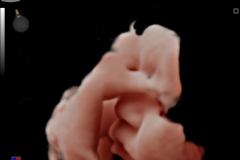 ecube9_diamond_gallery4_3d_4d_imaging_of_fetal_face_with_live_hq