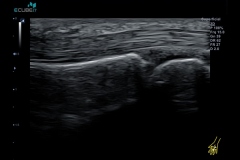 ecubei7_gallery15_mcp_join_and_its_tendon_with_transducer