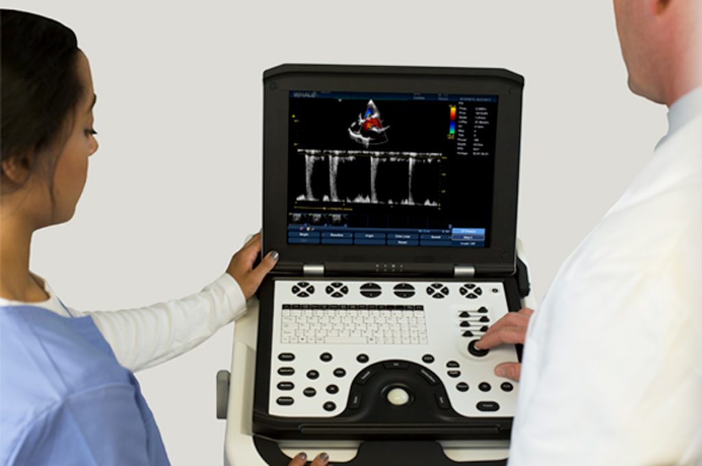 Lambda P9 Cardiac Ultrasound